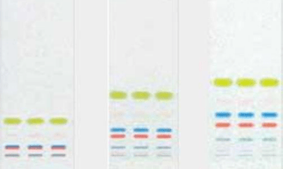 Postgrado en Técnicas Cromatográficas Líquidas Teoría-Práctica